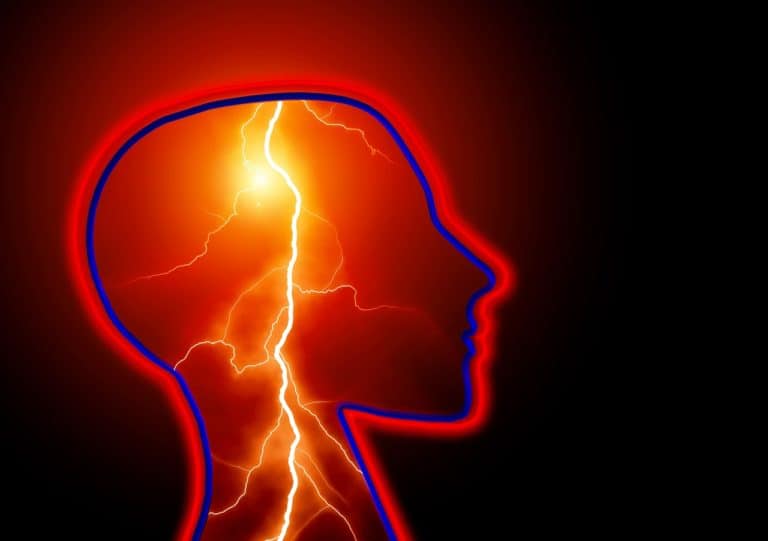 Plasticità Neuronale e Sclerosi Multipla