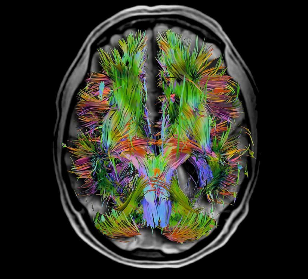Penetrare l’ignoto, la grande sfida del cervello umano