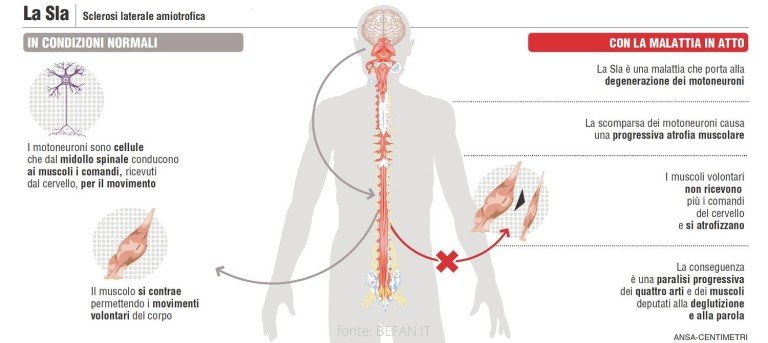 Un possibile target terapeutico per la SLA
